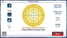 Sample Screens Fall Risk Screening Test